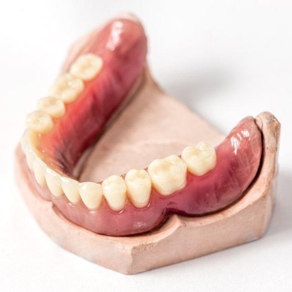 Lower Dentures Won'T Stay In Salt Lake City UT 84124